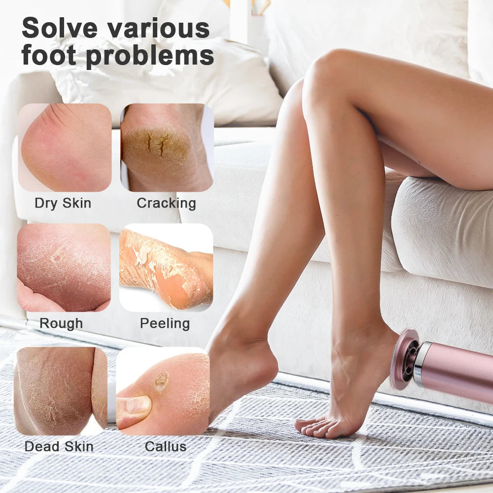 The Best Electric Pedicure Foot Callus Remover