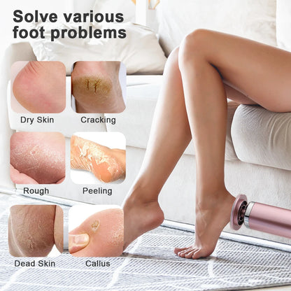 The Best Electric Pedicure Foot Callus Remover